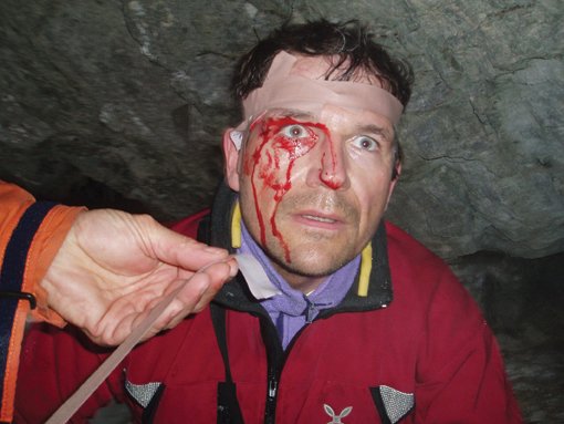 Der Unfall - ist meist schneller passiert als man denkt...